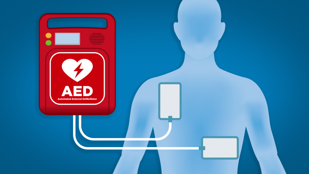 Person with an Automated External Defibrillator
